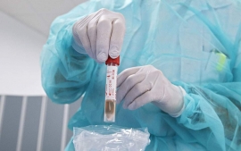 Προστασία έναντι της COVID-19 η ομάδα αίματος 0
